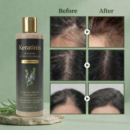 Keratinix™ Shampoo for Thinning & Fragile Hair