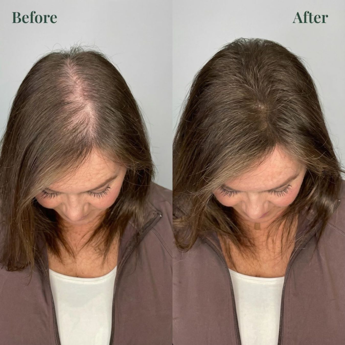 Keratinix™ Shampoo for Thinning & Fragile Hair