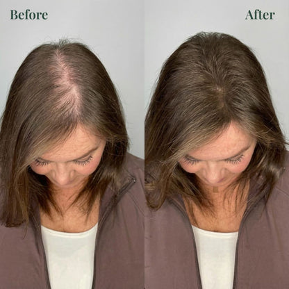 Keratinix™ Shampoo for Thinning & Fragile Hair